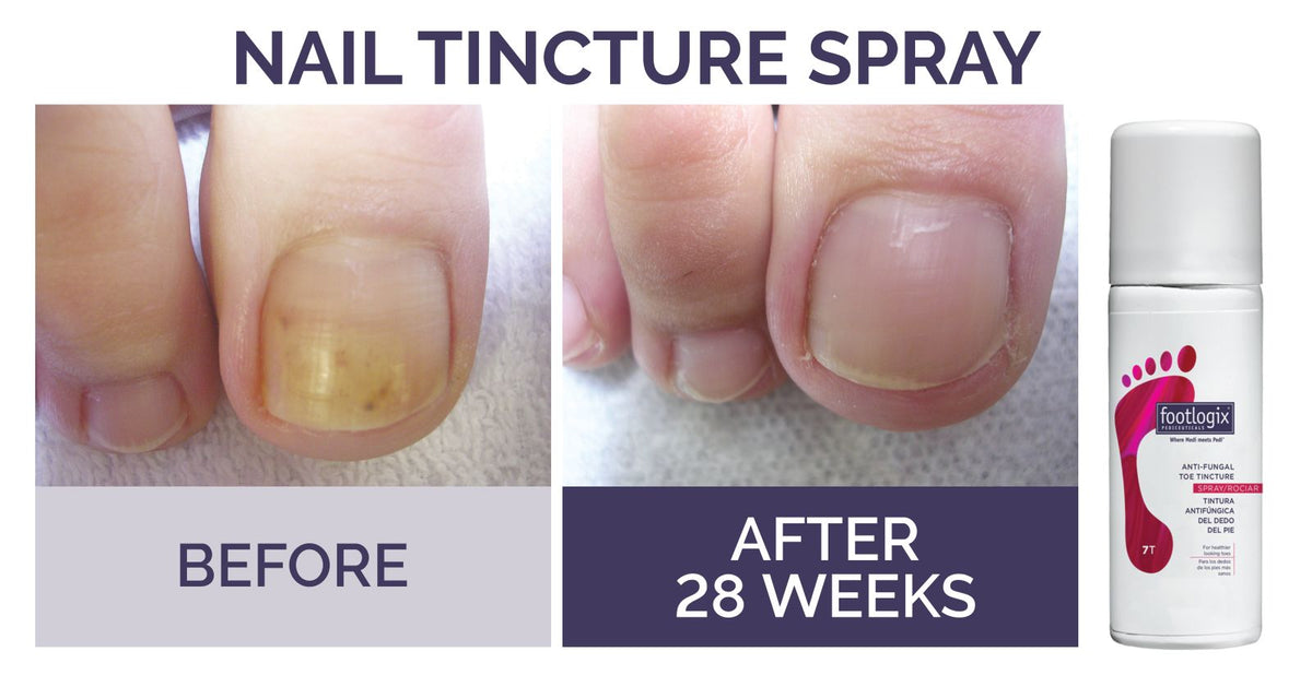 Footlogix Toe Nail Tincture 50ml